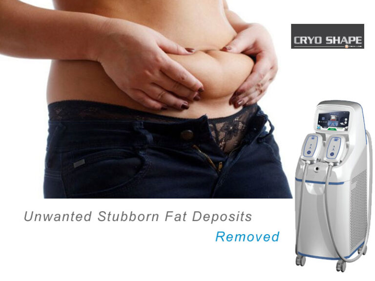 unwanted-fat-deposits